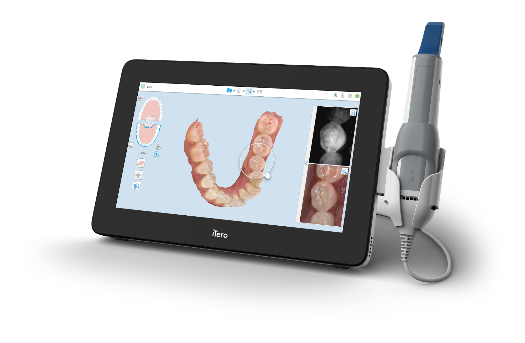 An iTero dental scanner illustration