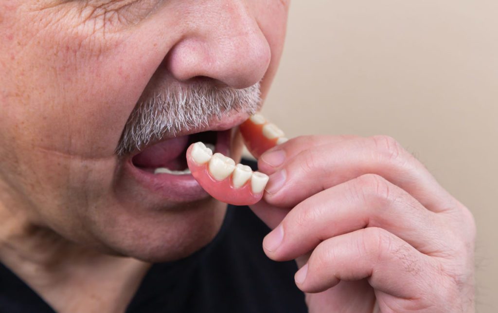 man in black crew neck shirt inserting dental implant