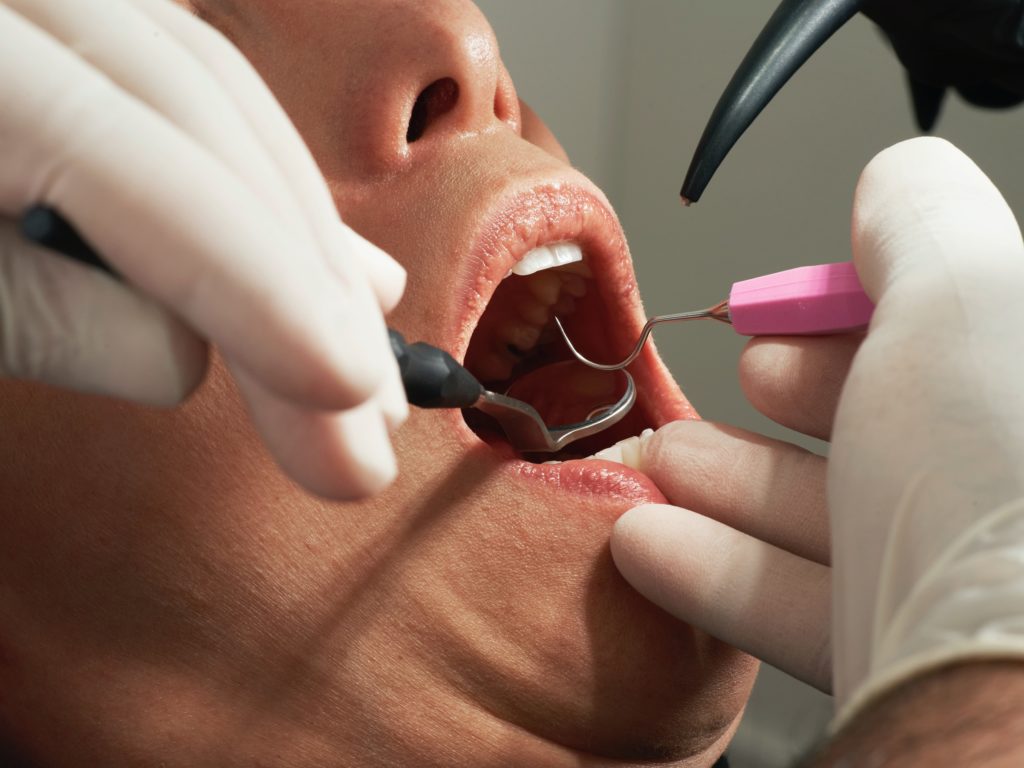 A dental hygienist inspects a patient’s teeth.