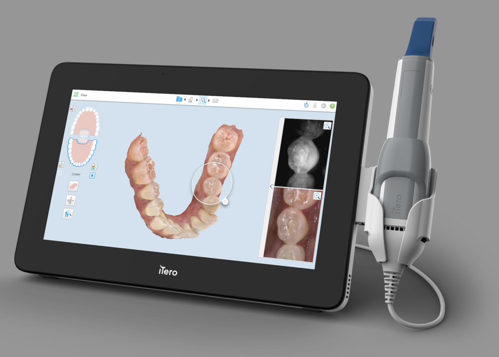 An iTero dental scanner with image display