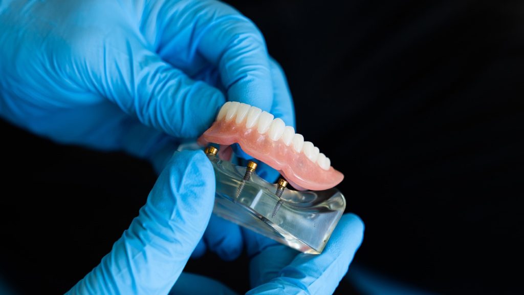 photo of implant dentures in gloved hands