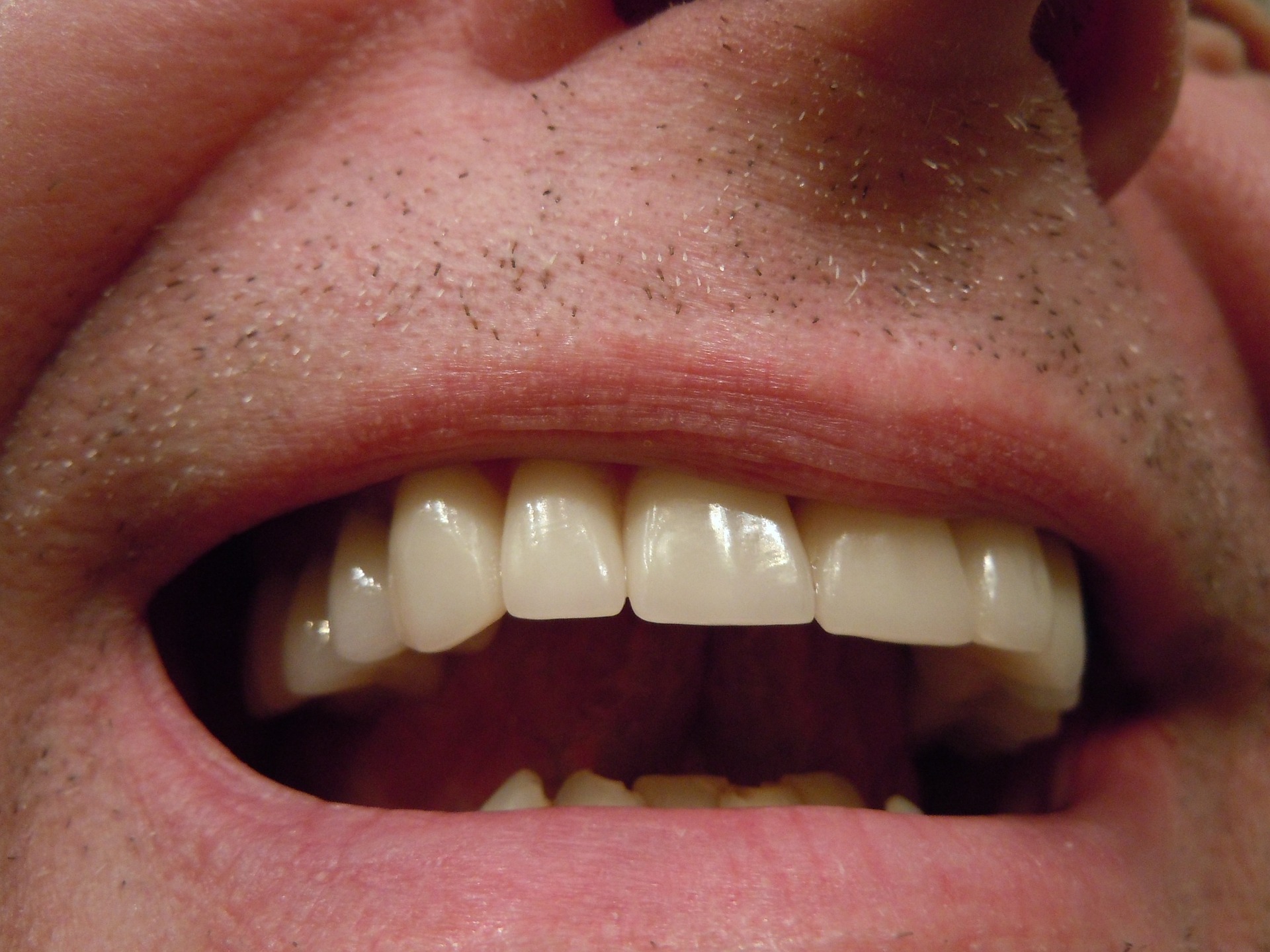 close-up photo of man’s teeth